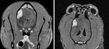 סריקת MRI של המוח לאחר הזרקת חומר ניגודי לווריד